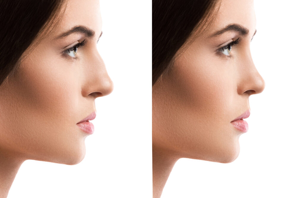 Female facial aesthetics consultation - Lunara Medical Travel