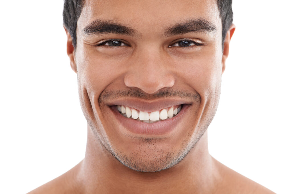 Confident smile after Hollywood Smile dental treatment in Türkiye